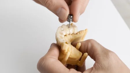 Modèle imprimé en résine
